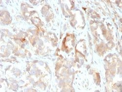 Cytokeratin 6 Antibody (KRT6B/2116) - Azide and BSA Free, Novus Biologicals